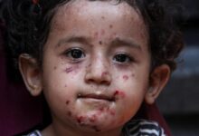 Tragedy of Gaza is turning into a never healing wound